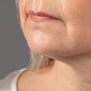 Rughe della marionetta: cause e come possono essere trattate