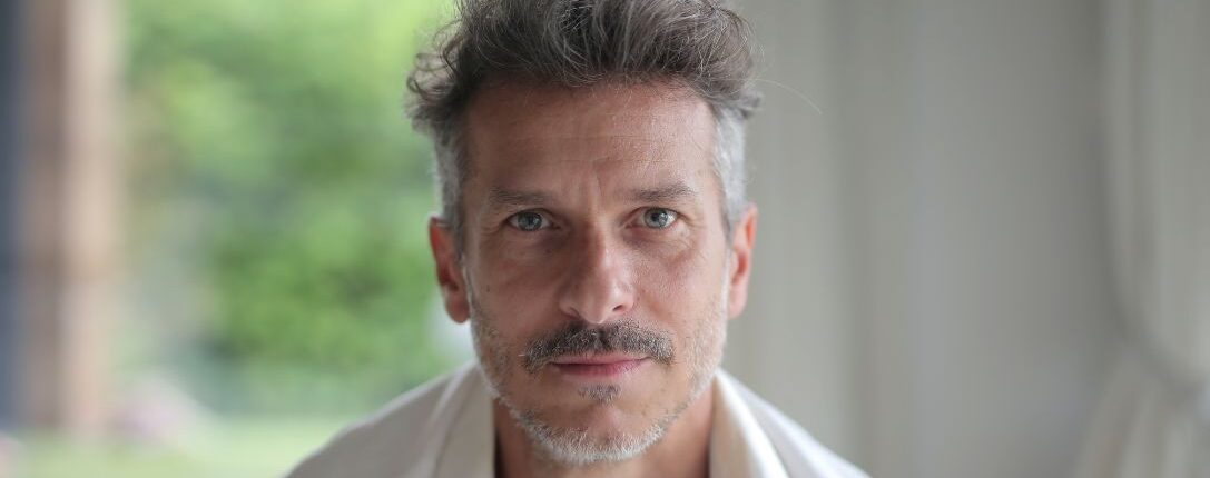 Trattamento delle rughe d'espressione uomo