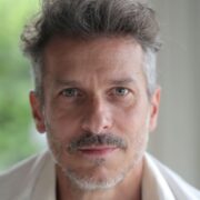 Trattamento delle rughe d'espressione uomo