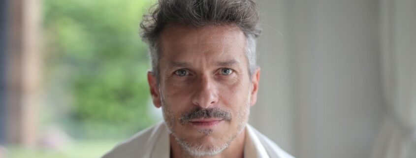 Trattamento delle rughe d'espressione uomo