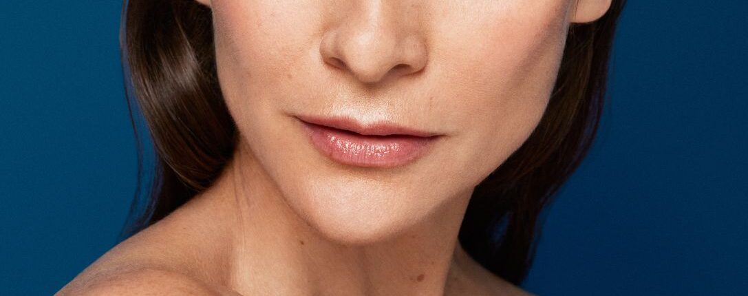 Rughe della marionetta e rughe nasolabiali ridurle con la biostimolazione rigenerativa