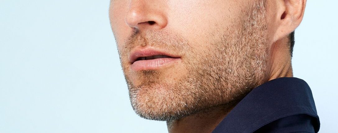 Biostimolazione con filler mandibola per una jawline definita