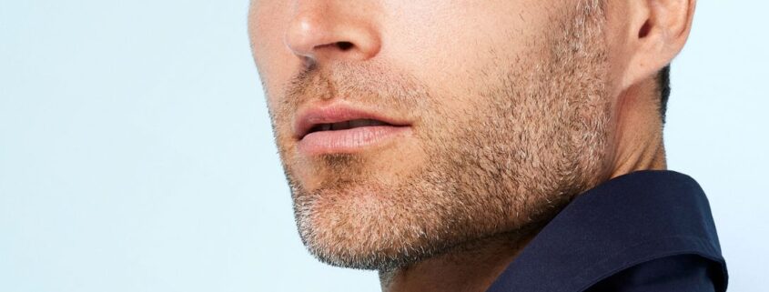 Biostimolazione con filler mandibola per una jawline definita