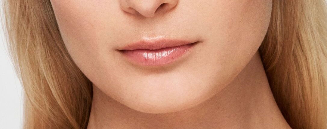 Biostimolazione rigenerativa per la definizione dell'angolo mandibolare e la riduzione delle rughe della marionetta