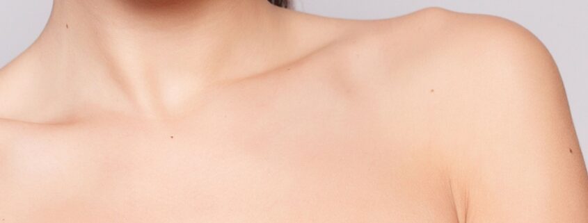 Ringiovanimento décolleté prevenire in primavera